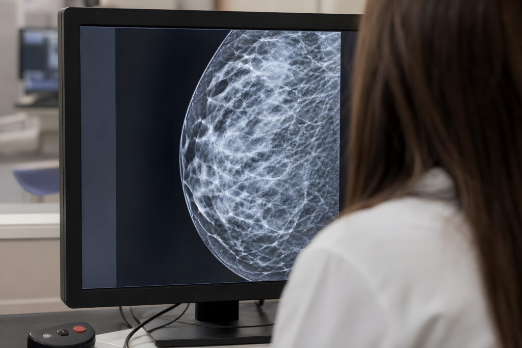 X-ray showing mammogram images at Jefferson Radiology in Wethersfield, CT.