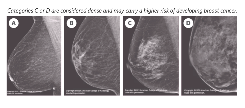 Breast density chart